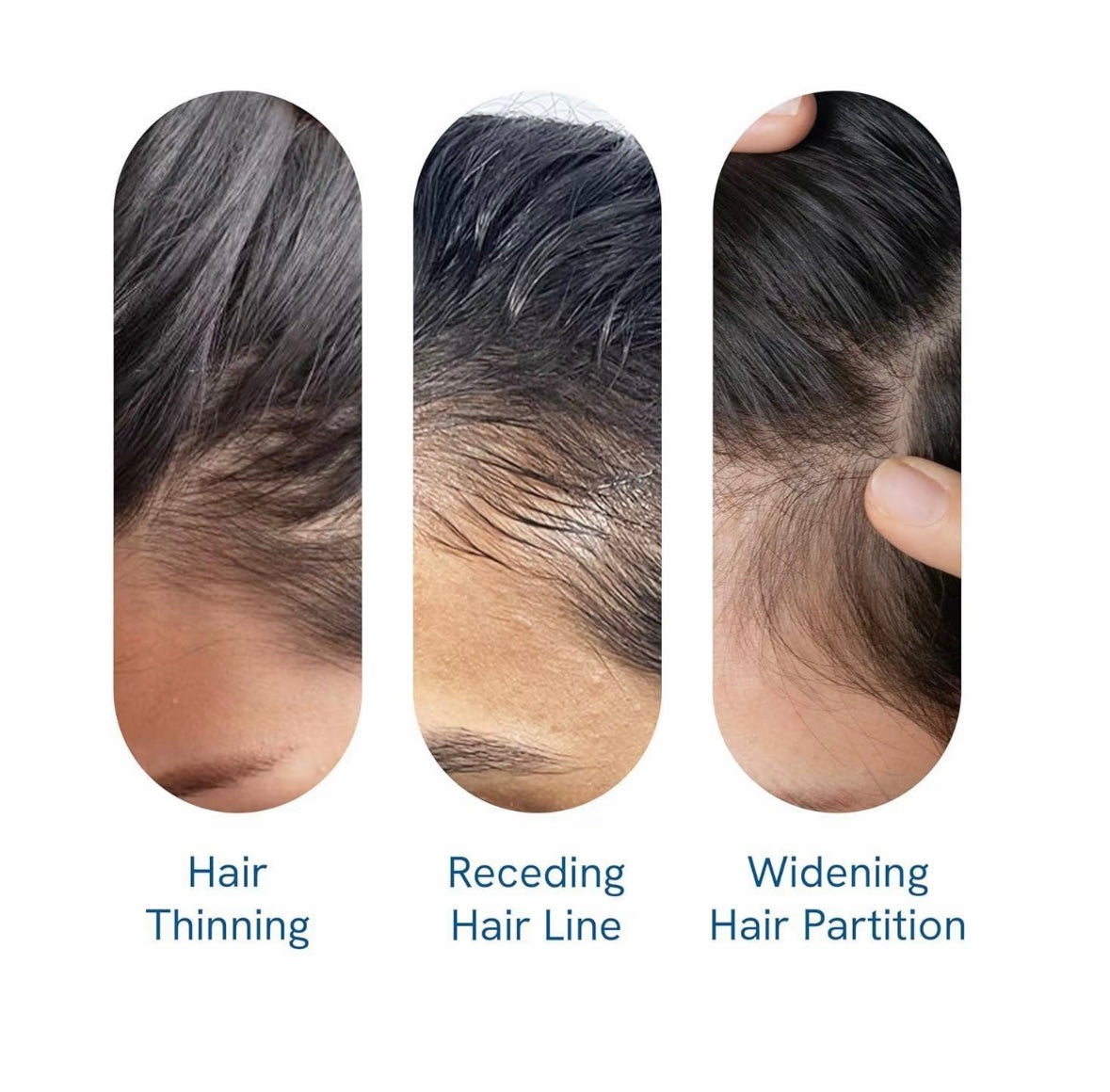 Hair Growth Roll-On Serum Precision Scalp Applicator